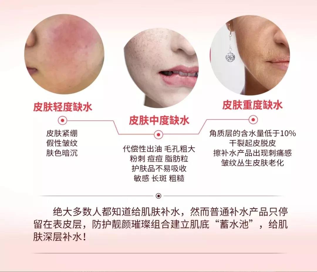 ��>��������Ƥ���չ˻�ʿ������һ��|���޽�������ob�羺ʵ����ս����!