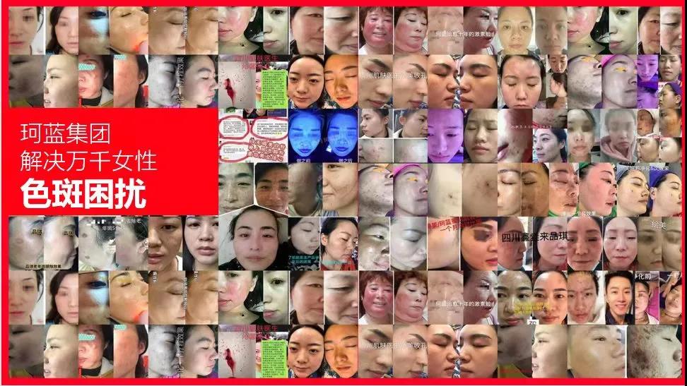 ����Ժ������ѡ��Ʒ��ob�羺